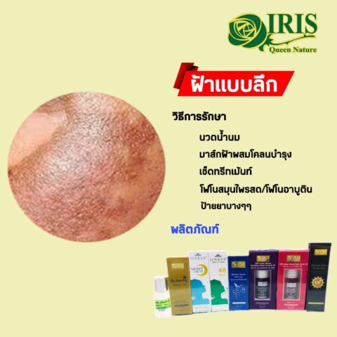 เซตฝ้าลึก
